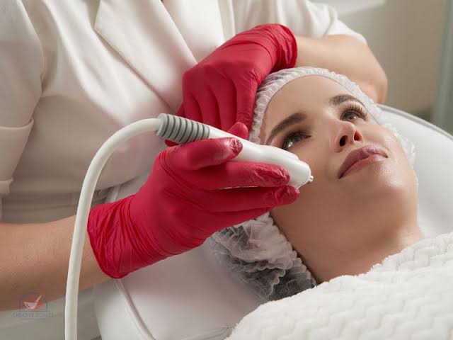 Derma Roller Treatment