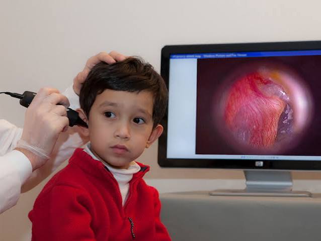 Ear Endoscopy Procedure