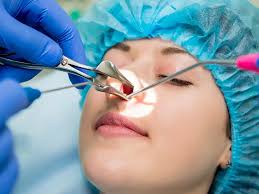 Nasal Endoscopy